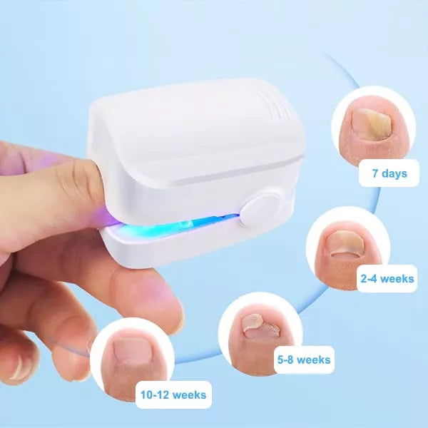 LASER PARA QUITAR HONGOS DE LAS UÑAS